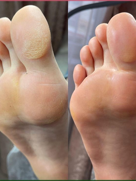 carrusel_pedicura_image_05