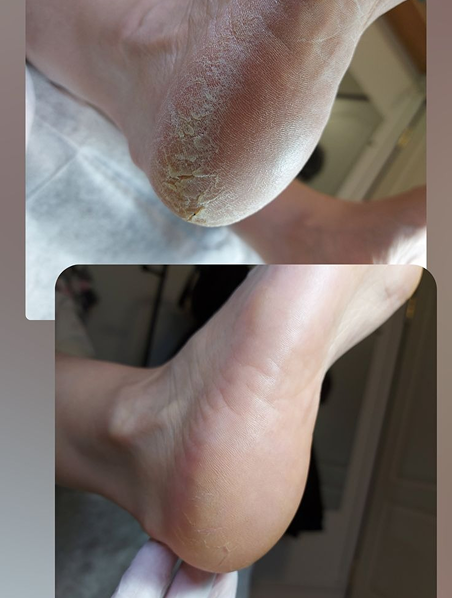 carrusel_pedicura_image_07